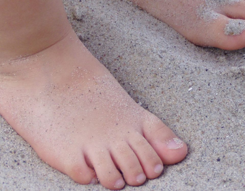 صافی کف پا در کودکان