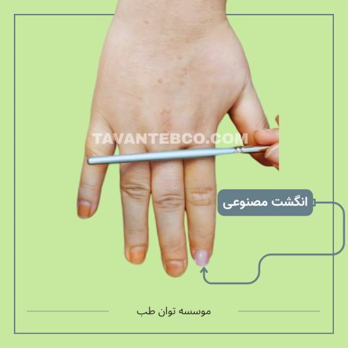 پروتز انگشت مصنوعی