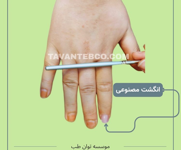 پروتز انگشت مصنوعی