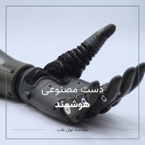 دست مصنوعی هوشمند