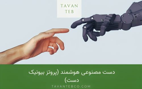 دست مصنوعی هوشمند (پروتز بیونیک دست)
