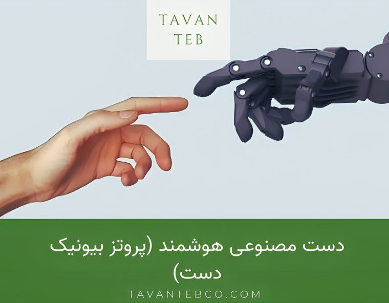 دست مصنوعی هوشمند (پروتز بیونیک دست)