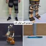 ارتوپدی فنی