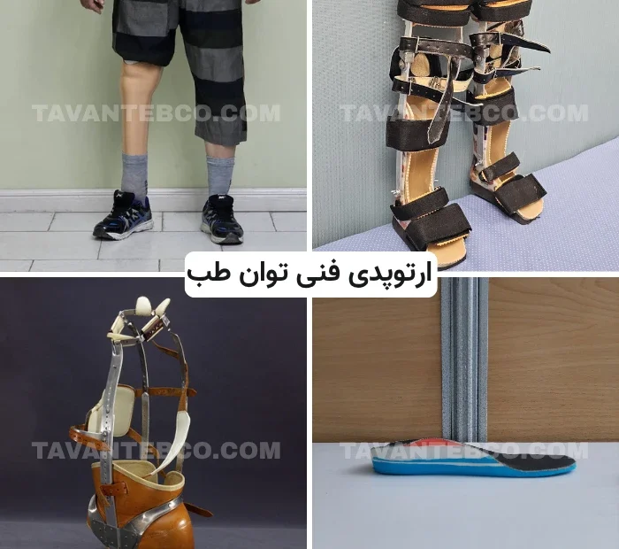 ارتوپدی فنی