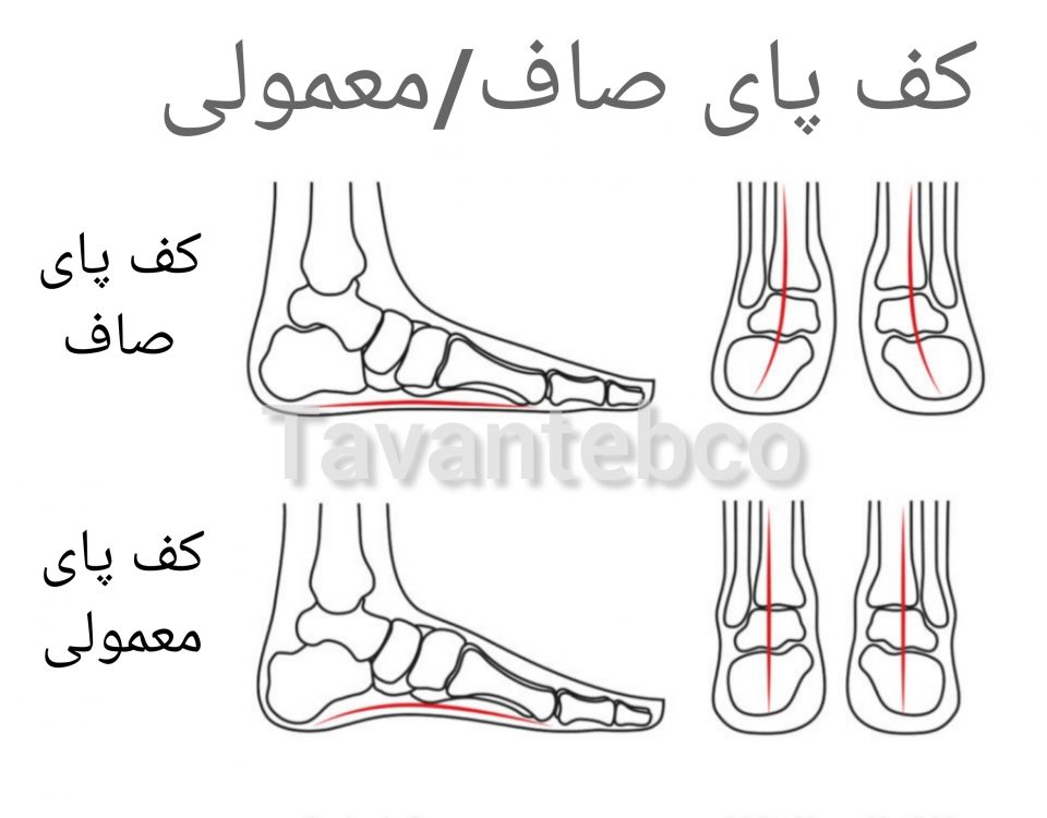 صافی کف پا