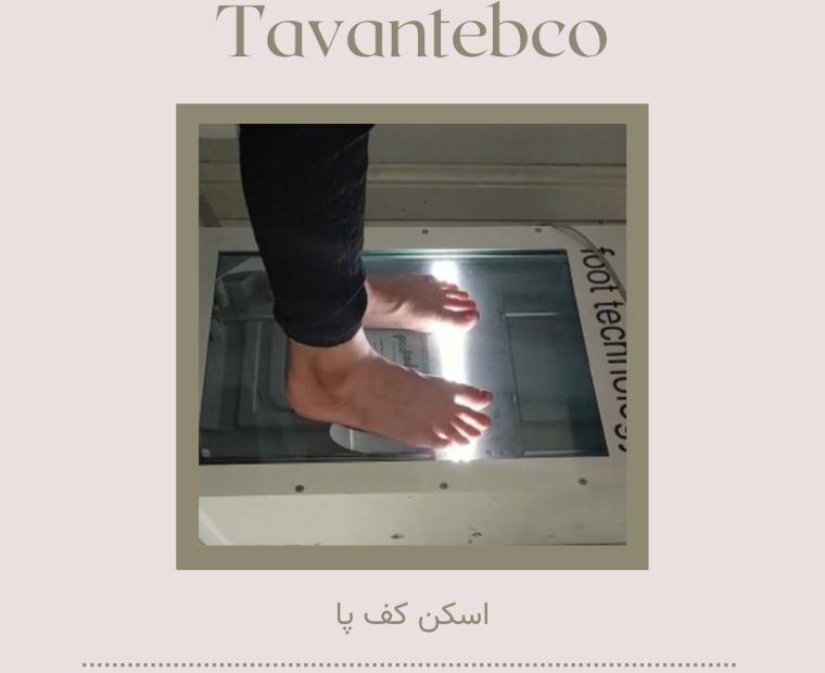 اسکن کف پا در تهران