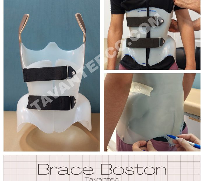 بریس بوستون