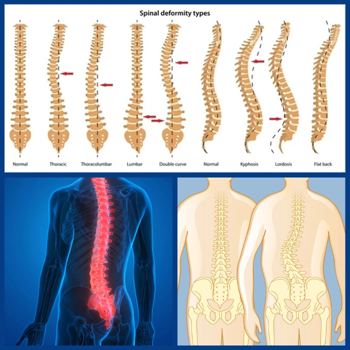 ستون فقرات و مشکلات ، تشخیص و درمان