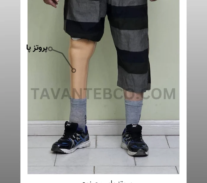 پروتز پای مصنوعی