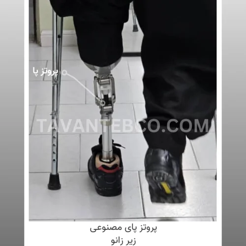 پروتز پای مصنوعی زیر زانو