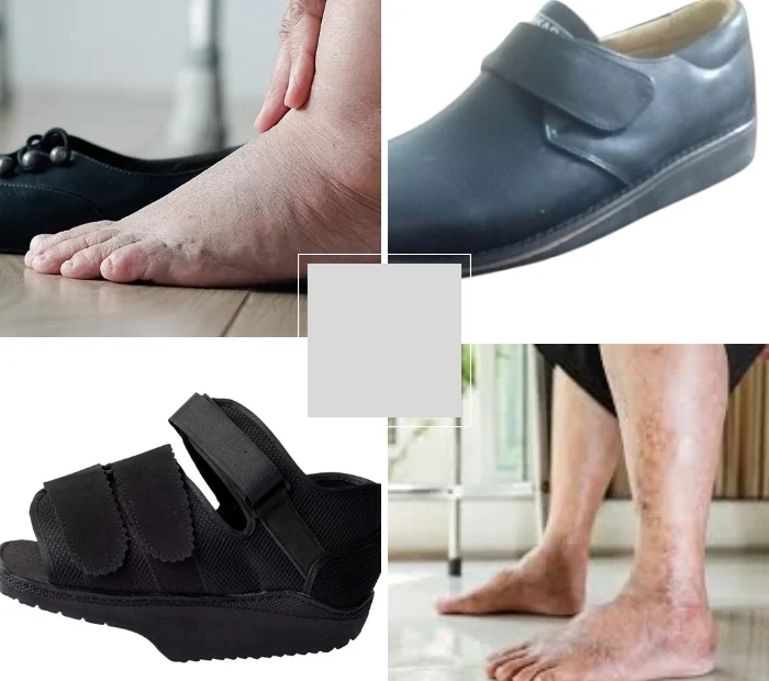 ساخت کفش دیابتی