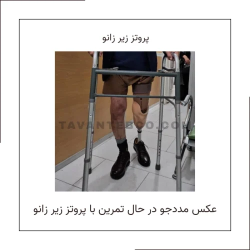 پروتز زیر زانو