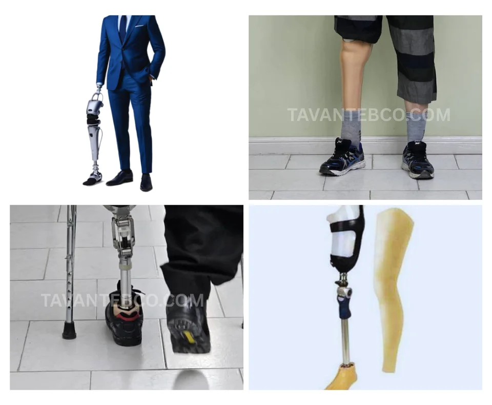 پروتز پای مصنوعی