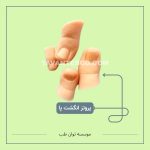 پروتز انگشت پا