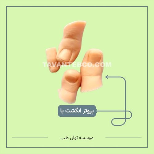 پروتز انگشت پا