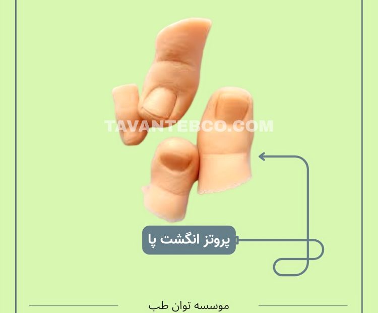 پروتز انگشت پا