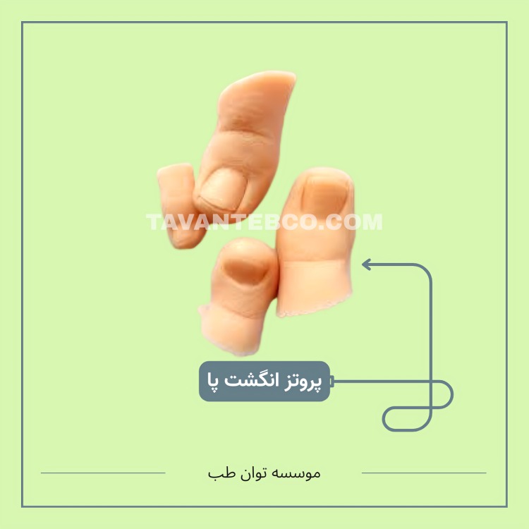 پروتز انگشت پا